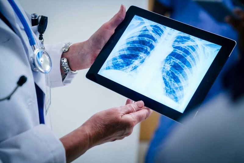 X-Ray Service